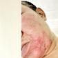 Abuja judge, therapist trade blame after cosmetic surgery goes wrong