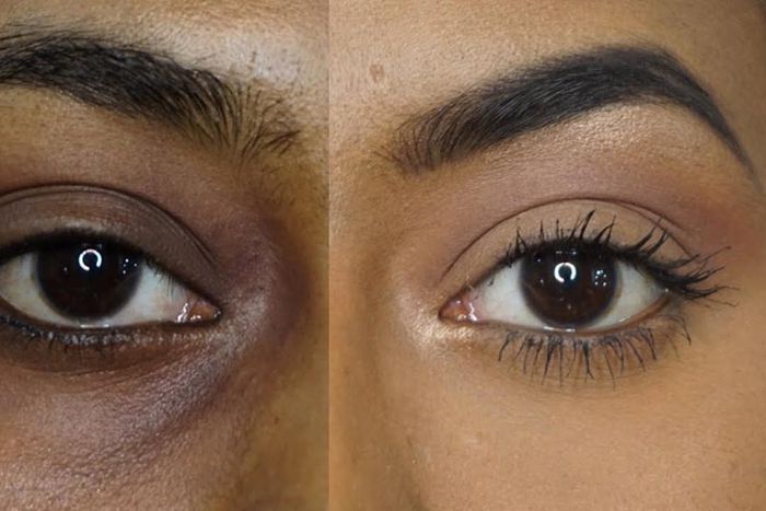 Here are some remedies for dark circles [Youtube]