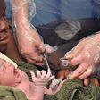 Facts about C-section [istock]