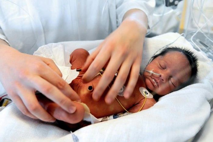 An artificial womb, tested on pre-natal lambs, could help extremely premature babies avoid death or disability
