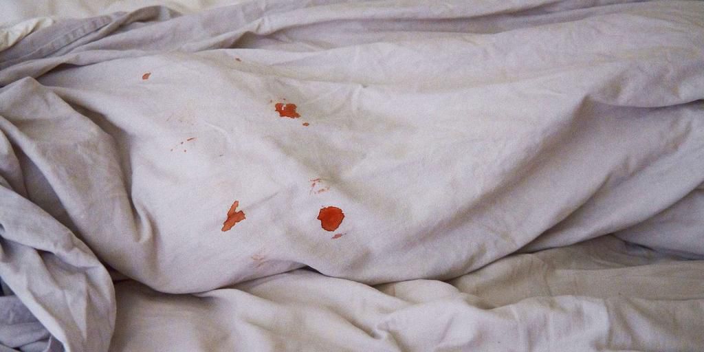 Period stains are common especially on beds [Today]