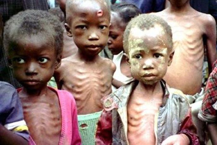 In 2017, Nutrition Society of Nigeria (NSN) blamed malnutrition for the high infant and under-five mortality rates in Nigeria