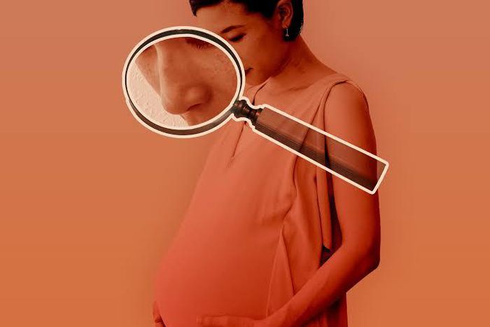 Luckily, the nose returns to its normal size after childbirth [Allure]