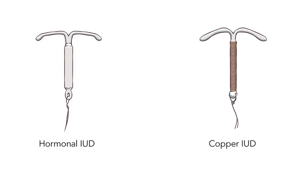 hormonal and copper iud [plannedparenthood]