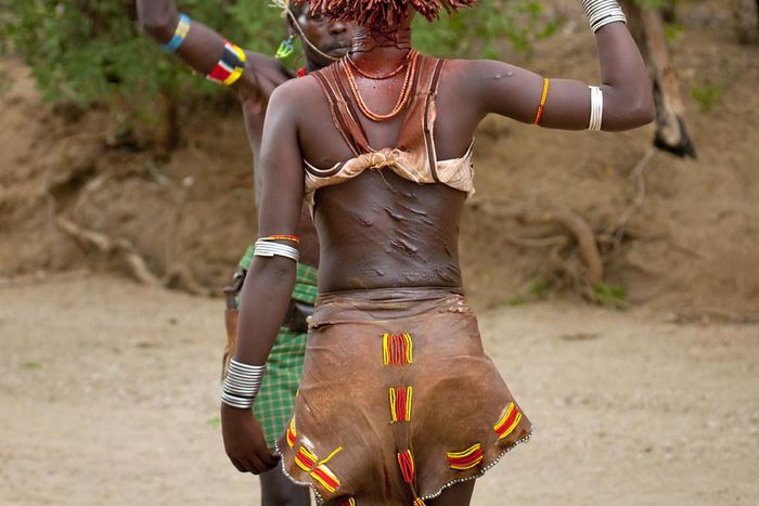 The scars are called marks of love [Flickr]