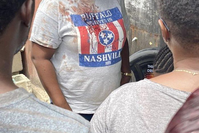 The woman voted despite the attack that left her face bandaged [Twitter/@Ozoadaz]