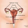 Cervical cancer