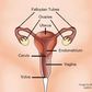Cervical cancer