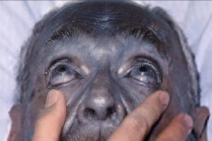 The blue people truly existed  [MidiLibre]