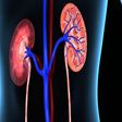 20m Nigerians have kidney diseases – Nephrologists. [tribuneonlineng]