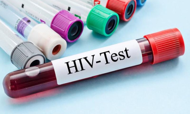 Nigeria set to begin production of HIV/AIDS test kits, anti-retroviral drugs