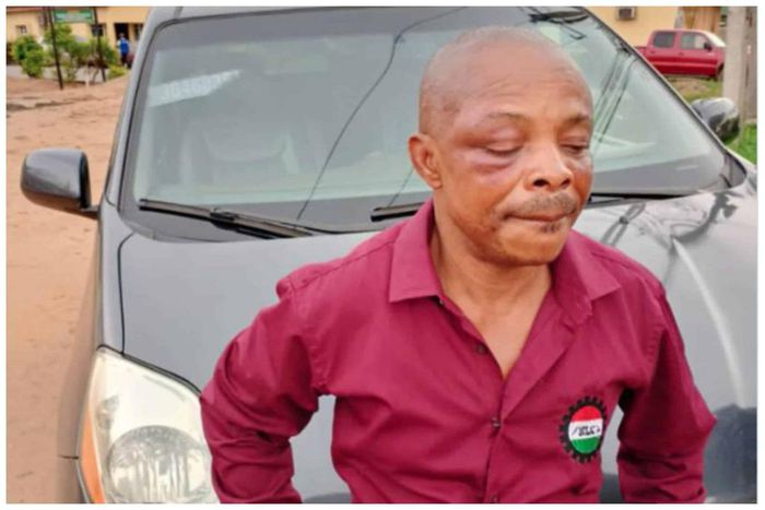 Joe Ajaero says he was beaten in police custody [NNews]