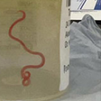 A live worm was found in a women's brain [skynews]