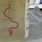 A live worm was found in a women's brain [skynews]