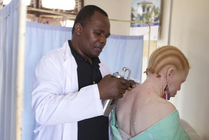 Albinos in Anambra seek support to prevent skin cancer