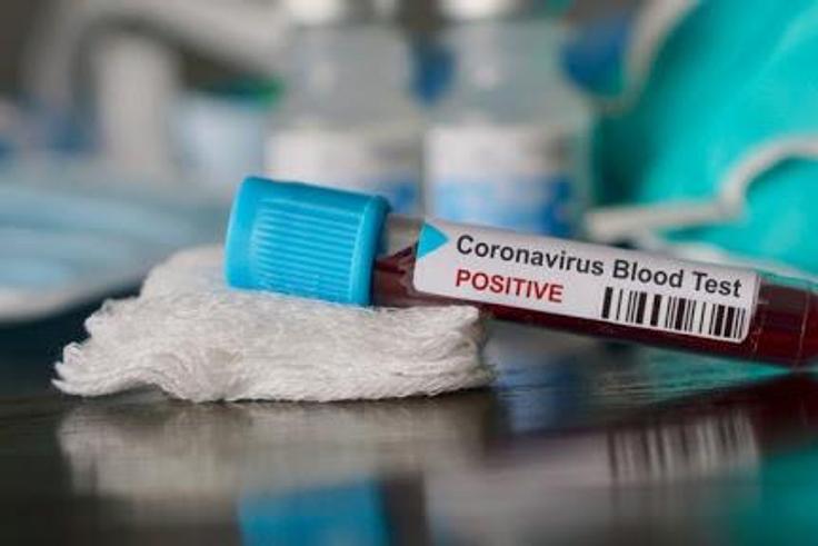COVID-19: Ghana records 414 new infections, case count moves up to 24,248