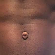 10 rare body features most people don't have (one's women-only)/Pexels