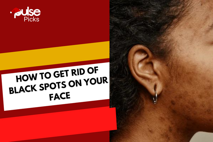 How to get rid of dark spots on your face