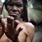 The finger-cutting as a mourning practice of the Dani People [Guardian]