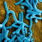Particles of Marburg virus are shown in false color here.
