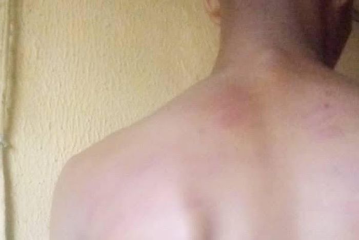 Image of a boy brutalised