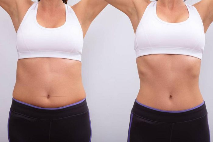 Liposuction offers six benefits.