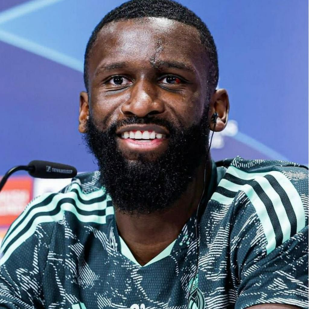 Rudiger shows off red eye, ready for Werner as Real Madrid clash with Leipzig