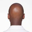 What makes men go bald in their 20s [istockphoto]