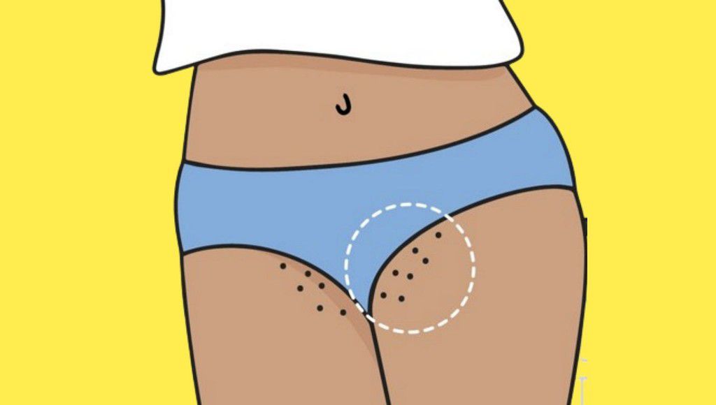 If the skin in your private area is exposed to friction it can thicken and darken overtime [Medium]