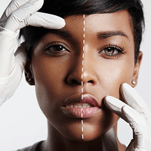 Toning  VS Bleaching: Get to know about these confused beauty terms