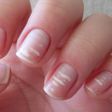 White marks on nails- Marine Healthfoods