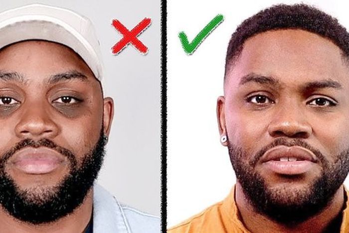 How do you get rid of dark circles under eyes? [Quora]