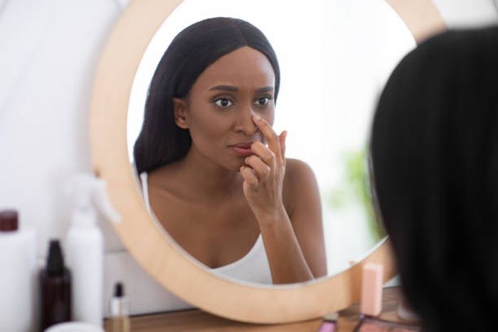 Why you get acne around your period [iStock]