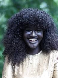 Benefits of dark complexion [NPR]