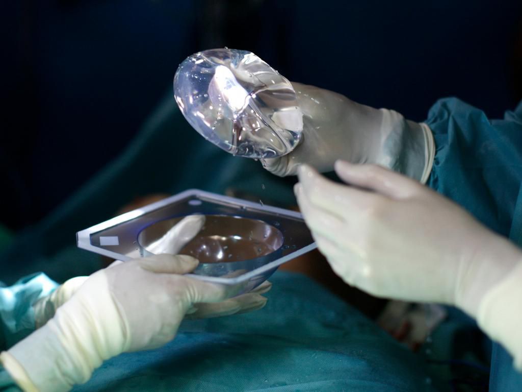 breast augmentation implant