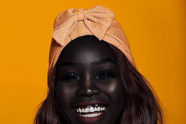Health benefits of people with dark complexion [boredpanda]