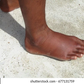Exercises that reduce leg swelling [shuttershock]