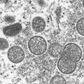 This electron microscopic (EM) image depicts monkeypox virus particles, obtained from a clinical specimen associated with the 2003 prairie dog outbreak. [Getty Images]