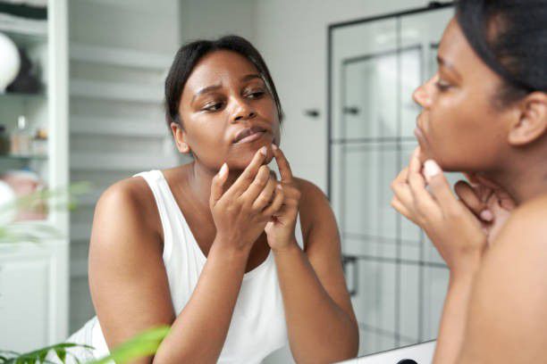 What causes hormonal acne? [iStock]