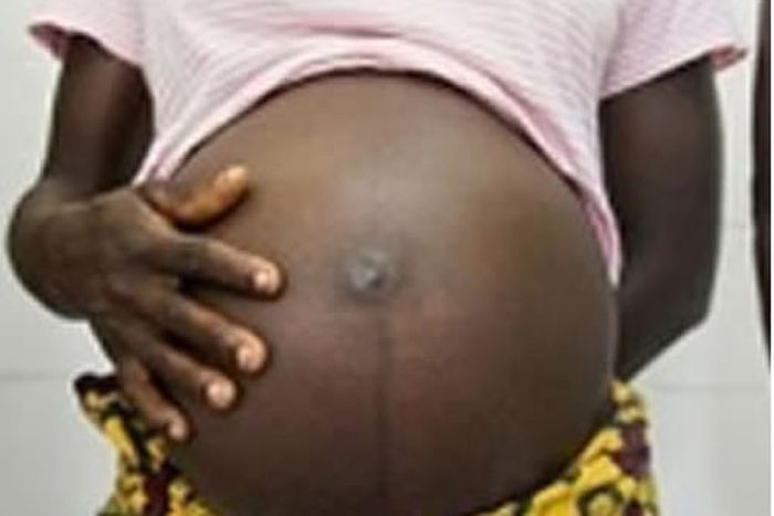 The victim will not be pressing charges [Punch]