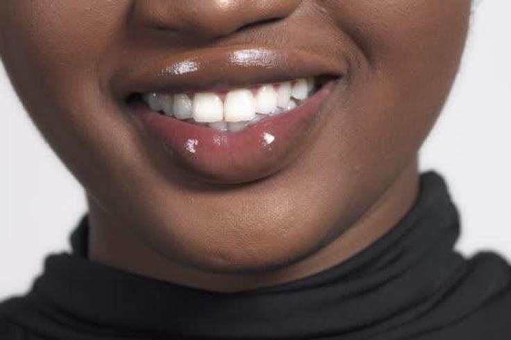 Woman with big lips