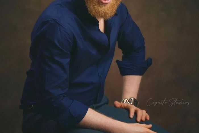 Damilola Ogunsi opens up about facing discrimination in Nollywood because he is Albino [Instagram/damilolaogunsi]