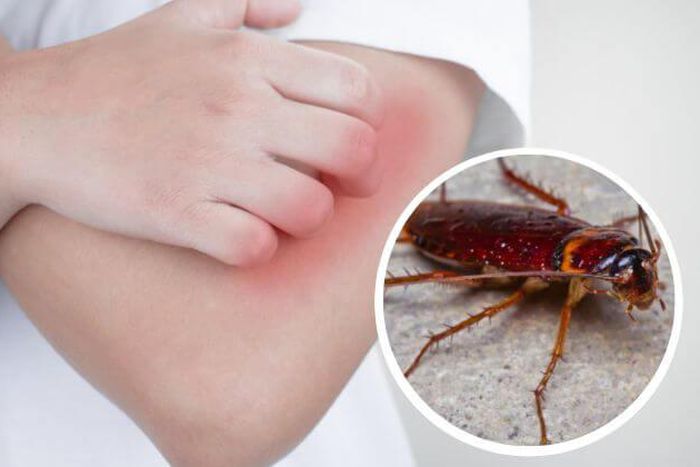 Do cockroaches bite and spread diseases? [24HourPestControl]