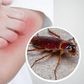 Do cockroaches bite and spread diseases? [24HourPestControl]