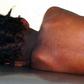 Measles (Wikimedia)