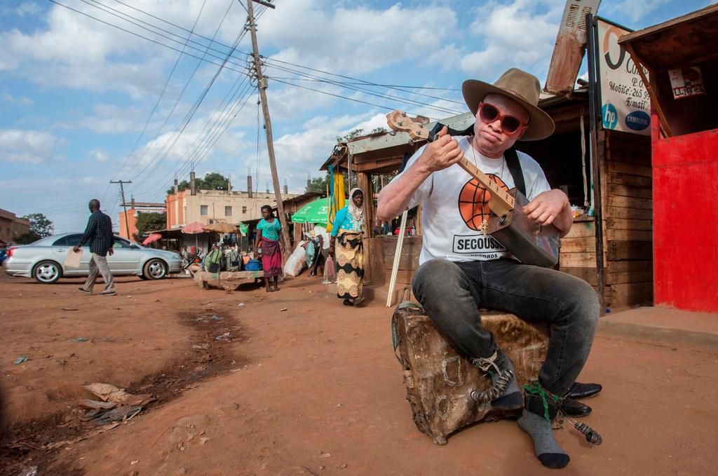 7 common myths about people living with Albinism [Getty Images]