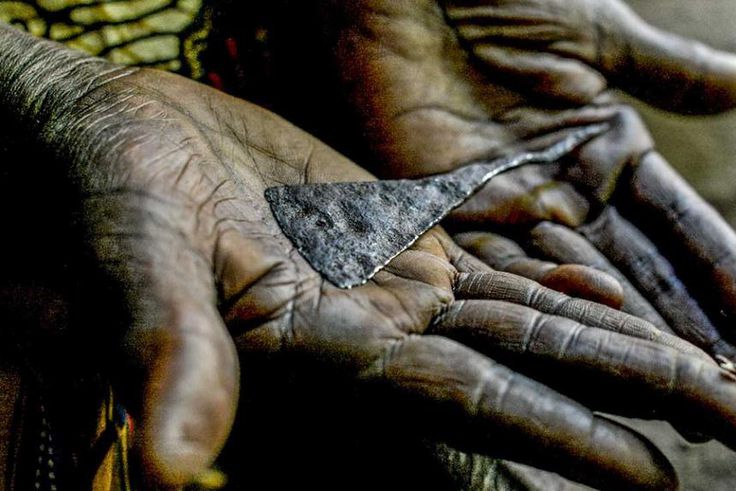 Female genital mutilation [healthline]