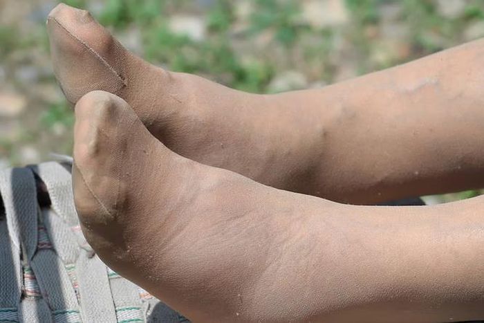 Awareness of some rather unusual symptoms of the disease remains low [Shutterstock]