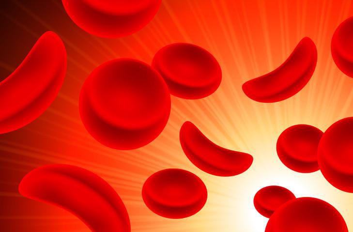 New drug for people with sickle cell [Harvardhealth]