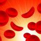 New drug for people with sickle cell [Harvardhealth]